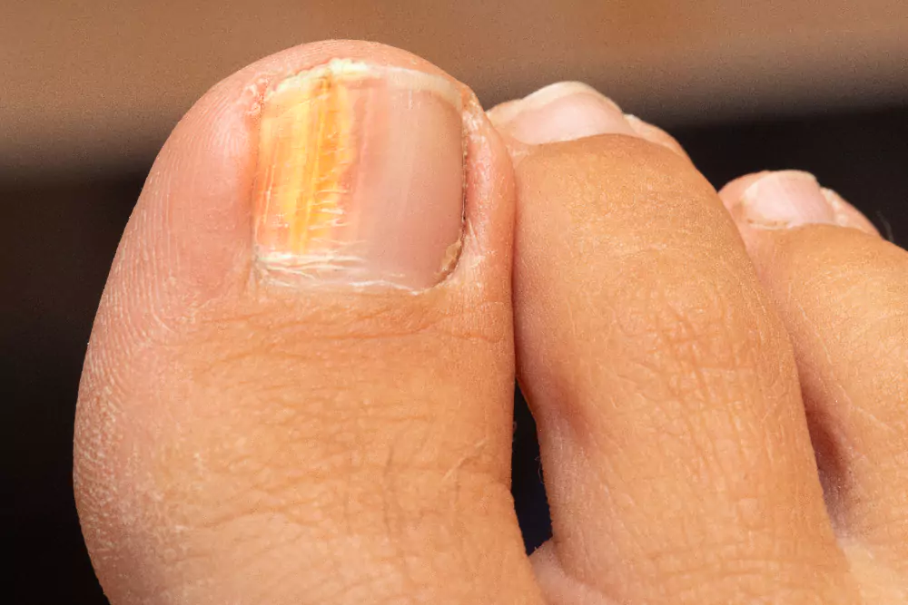 Nail Treatments